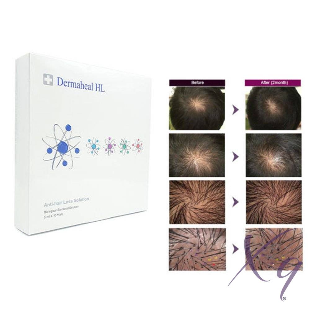 Dermaheal HL Hair Growth Solution - Image 3