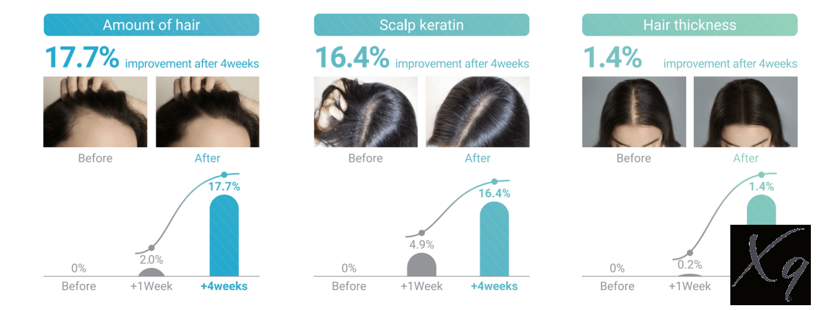 Velash Exo Plus Hair Scalp Treatment - Image 3